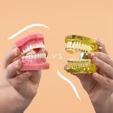 Windsor Invisalign: A Smart Investment in Professional Confidence